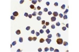 Immunocytochemical staining of K562 cells using Acinus antibody at 0. (ACIN1 Antikörper  (C-Term))