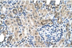 Human kidney (SLC19A1 Antikörper  (N-Term))