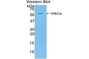 Western blot analysis of the recombinant protein. (Kallikrein 6 Antikörper  (AA 26-261))