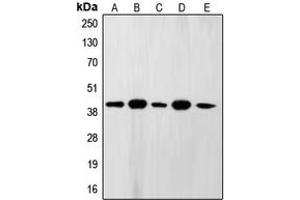 Western blot analysis of FEN1 expression in A431 (A), MCF7 (B), U937 (C), NIH3T3 (D), PC12 (E) whole cell lysates. (FEN1 Antikörper  (Center))