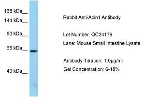 Host: Rabbit Target Name: Acin1 Sample Type: Mouse Small Intestine Antibody Dilution: 1.