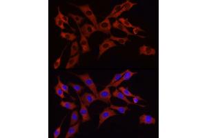Immunofluorescence analysis of NIH/3T3 cells using S6 Ribosomal Protein (RPS6) Rabbit mAb (ABIN7270026) at dilution of 1:100 (40x lens). (RPS6 Antikörper)