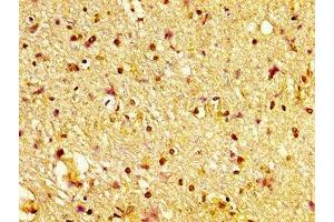 IHC image of ABIN7170335 diluted at 1:600 and staining in paraffin-embedded human brain tissue performed on a Leica BondTM system. (Sortilin 1 Antikörper  (AA 328-457))