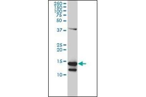 Western Blotting (WB) image for anti-CD247 Molecule (CD247) (AA 1-165) antibody (ABIN782349)