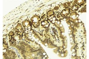 ABIN6276685 at 1/100 staining Mouse colon tissue by IHC-P. (Galectin 3 Antikörper  (Internal Region))