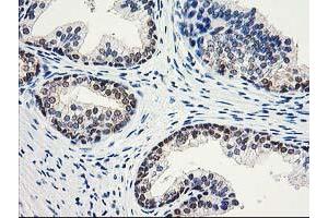 Image no. 7 for anti-Aminoacylase 1 (ACY1) antibody (ABIN1496454) (Aminoacylase 1 Antikörper)