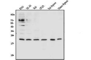 Western blot analysis of CD69 using anti-CD69 antibody (ABIN7599623). (CD69 Antikörper  (AA 101-148))
