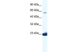 DDX55 antibody used at 1. (DDX55 Antikörper)