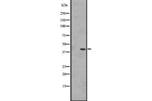 Western blot analysis of EBI2 expression in A431 whole cell lysate ,The lane on the left is treated with the antigen-specific peptide. (GPR183 Antikörper  (Internal Region))