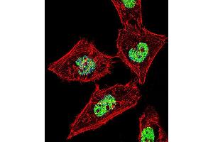 Fluorescent confocal image of Hela cell stained with RORA Antibody (T216). (RORA Antikörper  (AA 193-222))