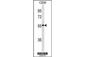 Image no. 1 for Mouse anti-Human IgA (AA 150-178) antibody (ABIN1480665) (Maus anti-Human IgA (AA 150-178) Antikörper)