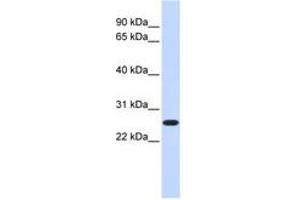 Image no. 1 for anti-CTD Nuclear Envelope Phosphatase 1a (CTDNEP1A) (C-Term) antibody (ABIN6740996) (CTDNEP1A Antikörper  (C-Term))