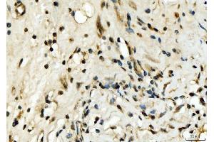 IHC analysis of EXOSC8 using anti-EXOSC8 antibody (ABIN7601850). (EXOSC8 Antikörper  (AA 49-216))