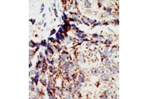 Image no. 1 for anti-BRCA1 Associated Protein-1 (Ubiquitin Carboxy-terminal Hydrolase) (BAP1) (N-Term) antibody (ABIN357594) (BAP1 Antikörper  (N-Term))