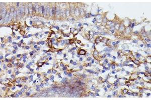 Immunohistochemistry of paraffin-embedded Human appendix using SNAP23 Polyclonal Antibody at dilution of 1:100 (40x lens). (SNAP23 Antikörper)