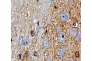 IHC-P analysis of Brain tissue, with DAB staining. (GDF10 Antikörper  (AA 337-477))