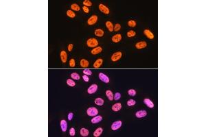 Immunofluorescence analysis of U-2 OS cells using hnRNP K Rabbit mAb (ABIN7267634) at dilution of 1:100 (40x lens). (HNRNPK Antikörper)