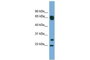 WB Suggested Anti-MMP26 Antibody Titration: 0. (MMP26 Antikörper  (C-Term))