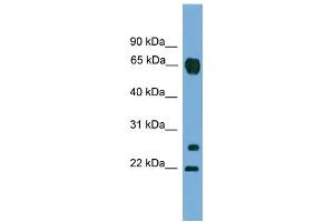 WB Suggested Anti-MMP26 Antibody Titration: 0.