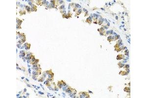 Immunohistochemistry of paraffin-embedded Mouse lung using TICAM1 Polyclonal Antibody at dilution of 1:100 (40x lens). (TICAM1 Antikörper)