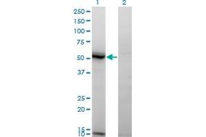 Western Blot analysis of ASAH1 expression in transfected 293T cell line by ASAH1 monoclonal antibody (M02), clone 1A7.