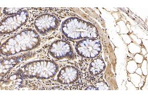 Detection of IFNb in Human Colon Tissue using Monoclonal Antibody to Interferon Beta (IFNb) (IFNB1 Antikörper)