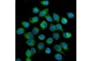 IF analysis of SLC2A1 using anti-SLC2A1 antibody (ABIN6719416).
