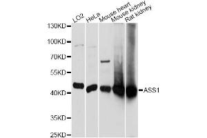 Western blot analysis of extracts of various cell lines, using ASS1 antibody. (ASS1 Antikörper)