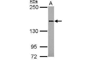 WB Image Sample (30 ug of whole cell lysate) A: 293T 5% SDS PAGE antibody diluted at 1:1000 (SEMA4D/CD100 Antikörper)
