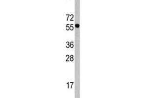 Western blot analysis of CDC6 antibody in Ramos lysate. (CDC6 Antikörper  (AA 32-61))