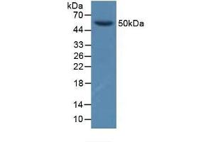 Detection of GFRa1 in Porcine Brain Tissue using Polyclonal Antibody to Glial Cell Line Derived Neurotrophic Factor Receptor Alpha 1 (GFRa1) (GFRA1 Antikörper  (AA 239-350))