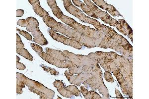 IHC analysis of TNNI1 using anti-TNNI1 antibody (ABIN7603242).