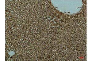 Immunohistochemistry (IHC) analysis of paraffin-embedded Rat Liver Tissue using PI3 Kinase P85 alpha Mouse Monoclonal Antibody diluted at 1:200.