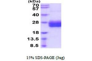 SDS-PAGE (SDS) image for NUDC (AA 1-331) protein (His tag) (ABIN5854672) (NUDC Protein (AA 1-331) (His tag))