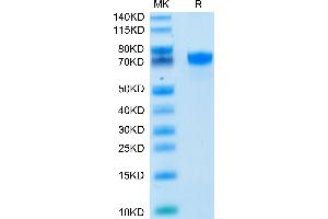 Human PD-L1 on Tris-Bis PAGE under reduced condition. (PD-L1 Protein (AA 19-238) (Fc Tag))