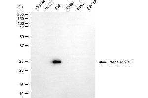 Western blotting analysis using interleukin 32 antibody (ABIN7799106).