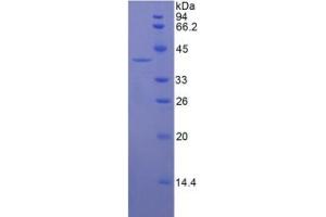 SDS-PAGE analysis of Human Keratin 16 Protein.
