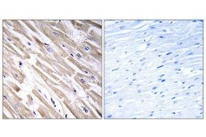 Immunohistochemistry (IHC) image for anti-Fibroblast Growth Factor 18 (FGF18) (C-Term) antibody (ABIN1850382)