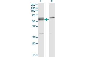 Western Blot analysis of SFRS6 expression in transfected 293T cell line by SFRS6 monoclonal antibody (M02), clone 5G6. (SFRS6 Antikörper  (AA 1-75))
