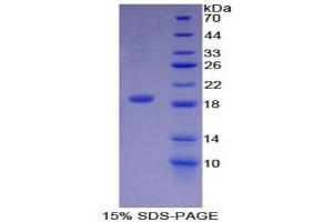 SDS-PAGE analysis of Human Dermcidin Protein. (Dermcidin Protein (DCD))