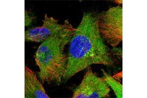 Immunofluorescent staining of human cell line U-251 MG shows positivity in plasma membrane, cytoplasm & golgi apparatus.
