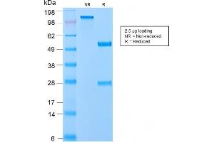 SDS-PAGE Analysis of Purified VLDL-Receptor Rabbit Recombinant Monoclonal Antibody (VLDLR/2896R). (Rekombinanter VLDLR Antikörper  (C-Term))