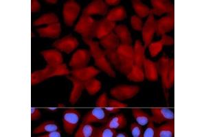 Immunofluorescence analysis of U2OS cells using EIF5A Polyclonal Antibody (EIF5A Antikörper)