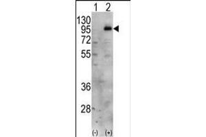 Western blot analysis of PIP5K1C (arrow) using PIP5K1G Antibody (C-term) (ABIN392596 and ABIN2842125). (PIP5K1C Antikörper  (C-Term))