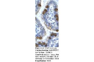 Immunohistochemistry (IHC) image for anti-Cyclin-Dependent Kinase 7 (CDK7) (C-Term) antibody (ABIN2792153) (CDK7 Antikörper  (C-Term))