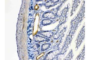 ANGPTL2 was detected in paraffin-embedded sections of rat intestine tissues using rabbit anti- ANGPTL2 Antigen Affinity purified polyclonal antibody (Catalog # ) at 1 µg/mL. (ANGPTL2 Antikörper  (Middle Region))