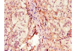 Immunohistochemistry of paraffin-embedded human adrenal gland tissue using ABIN7162949 at dilution of 1:100 (ACOX1 Antikörper  (AA 113-273))