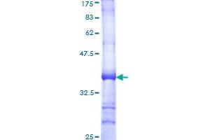 Image no. 1 for Interleukin 18 Receptor 1 (IL18R1) (AA 22-121) protein (GST tag) (ABIN1307726)