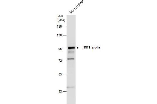 HNF1A Antikörper