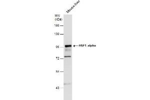 WB Image HNF1 alpha antibody [N1N3] detects HNF1 alpha protein by western blot analysis. (HNF1A Antikörper)
